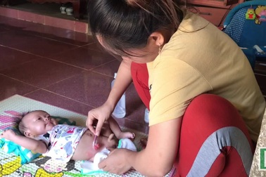 Thương cháu bé 3 tháng tuổi khổ sở với hậu môn nhân tạo