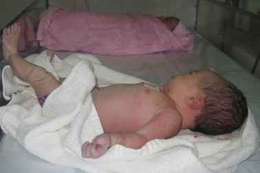 Bé gái nặng 6kg chào đời tại bệnh viện Từ Dũ