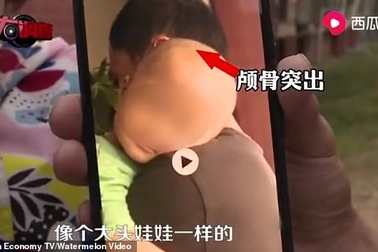 Trung Quốc điều tra nghi vấn sữa giả làm trẻ sơ sinh to đầu