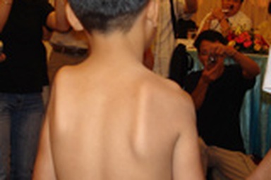 "Cơ sở "mổ chui" bệnh xơ hóa cơ delta quá tồi tàn!"