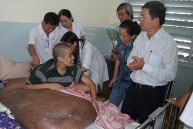 Người mang khối u 90kg không thể bước vào ca phẫu thuật