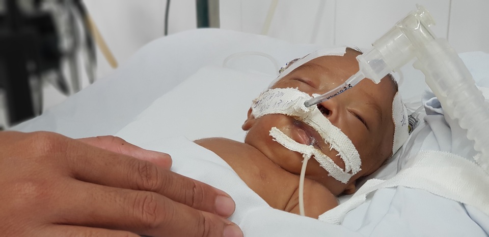 Hài nhi bị bỏ rơi trong sân chùa đang rất cần sự chung tay của cộng đồng - 1 Hài nhi bị bỏ rơi trong sân chùa đang rất cần sự chung tay của cộng đồng - 1