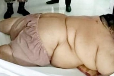 Người đàn ông béo phì phải nhập viện bằng xe tải hạng nặng