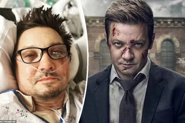 Vừa chụp ảnh bị thương tích, tài tử gặp tai nạn nguy kịch ngoài đời thực