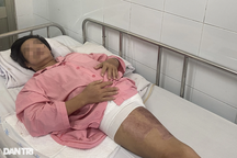 Bị container cán nát vùng kín, bệnh nhân sống "thần kỳ" sau 11 lần mổ