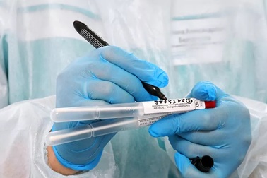 Mất khứu giác khi mắc Covid-19 sẽ có phản ứng miễn dịch mạnh hơn?