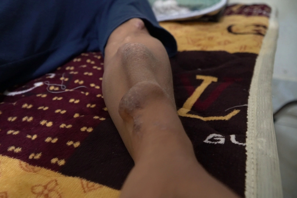 Nước mắt người vợ trẻ gần 10 năm xuyên Tết chăm chồng, con ở viện - 4 Nước mắt người vợ trẻ gần 10 năm xuyên Tết chăm chồng, con ở viện - 4