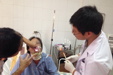 Từ vết loét nhỏ đến... ung thư lưỡi