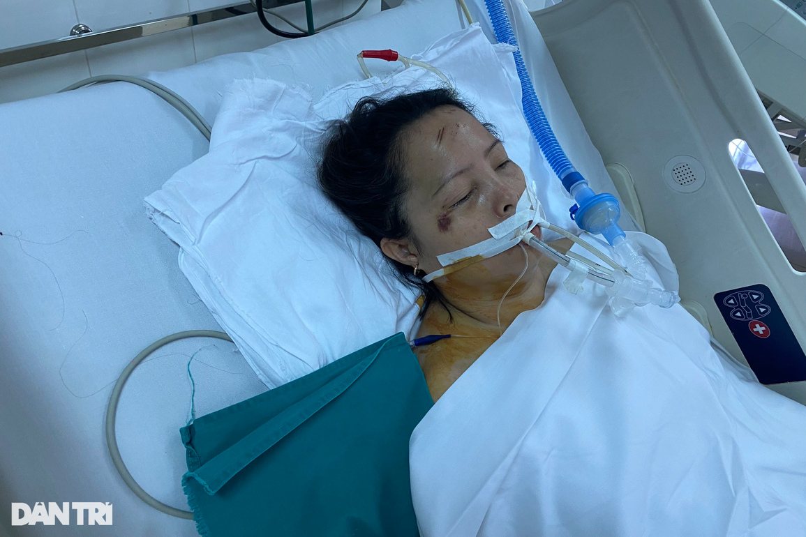 Bác sĩ cầu cứu giúp người mẹ nghèo nguy kịch sau tai nạn thảm khốc - 5 Bác sĩ cầu cứu giúp người mẹ nghèo nguy kịch sau tai nạn thảm khốc - 5