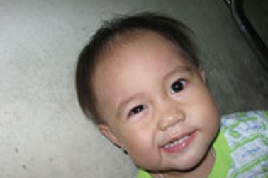 Trẻ dễ bị méo miệng mùa lạnh