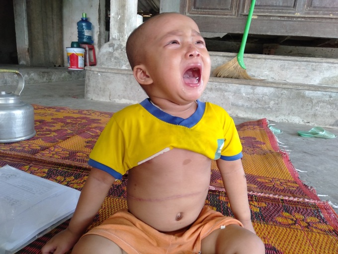 Không cam chịu con gái 3 tuổi chết mòn vì bệnh tật, vợ chồng nghèo sang Lào nhặt phế liệu kiếm tiền chữa bệnh cho con - Ảnh 1. Không cam chịu con gái 3 tuổi chết mòn vì bệnh tật, vợ chồng nghèo sang Lào nhặt phế liệu kiếm tiền chữa bệnh cho con - Ảnh 1.