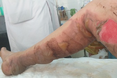 Vụ người phụ nữ bị ném “bom xăng”: Kẻ lạ mặt từng 2 lần đến đánh, đốt!