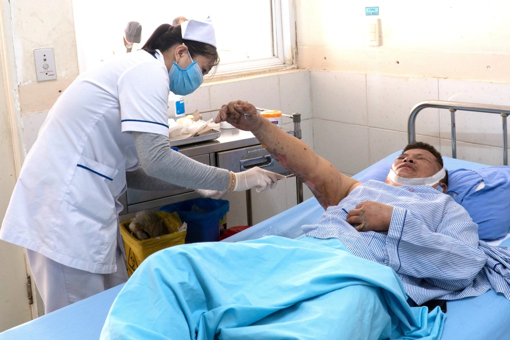 Chưa xác định được nguyên nhân vụ nổ tại Công ty SGI Vina - 1 Chưa xác định được nguyên nhân vụ nổ tại Công ty SGI Vina - 1