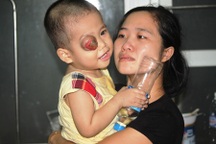 Tiếng khóc xé lòng của cháu bé 2 tuổi có đôi mắt sắp “nổ tung”