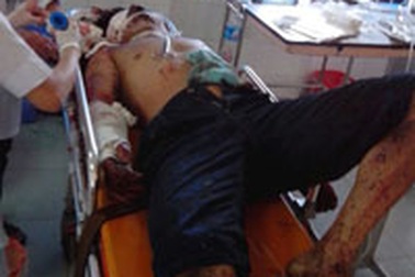 Nổ lớn do cưa đầu pháo, 2 người bị thương