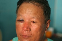 Gọi côn đồ đánh người để… cướp thùng phiếu bầu