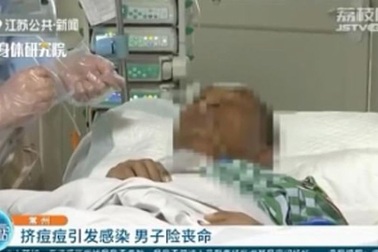 Suýt chết vì không nghe vợ, quyết nặn mụn ở cằm