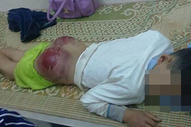 Học sinh lớp 7 bị bố đánh dã man: Đừng quan niệm “thương cho roi cho vọt”