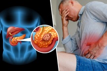 Đau vùng thượng vị, vàng da, buồn nôn: Coi chừng ung thư tuyến tụy