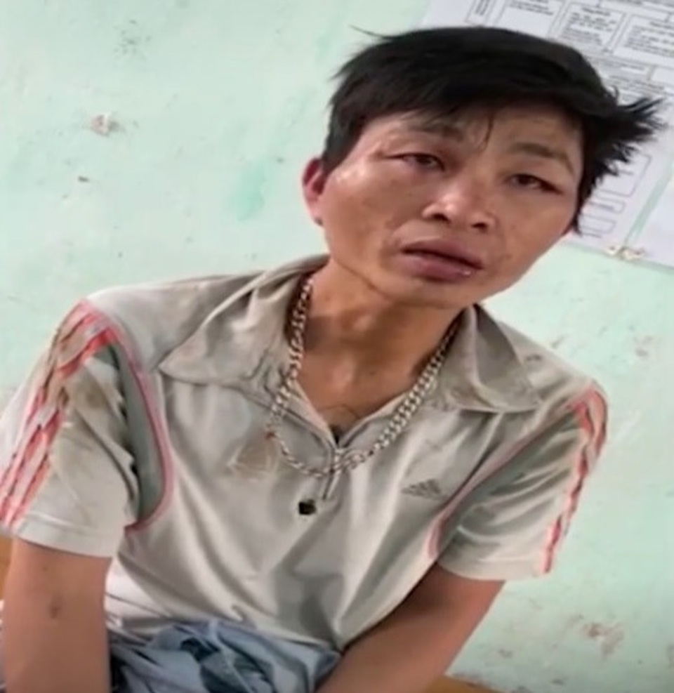 Bị phát hiện, “cẩu tặc” hung hãn dùng dao chém chủ chó bị thương - 1 Bị phát hiện, “cẩu tặc” hung hãn dùng dao chém chủ chó bị thương - 1