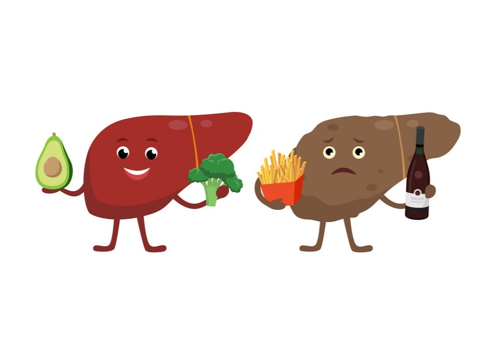 Gan nhiễm mỡ độ 2 kiêng gì và nên ăn gì? - 1