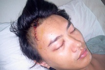 Ca sĩ Tuấn Khanh bị đánh vỡ sọ: Do băng nhóm đòi “bảo kê”?