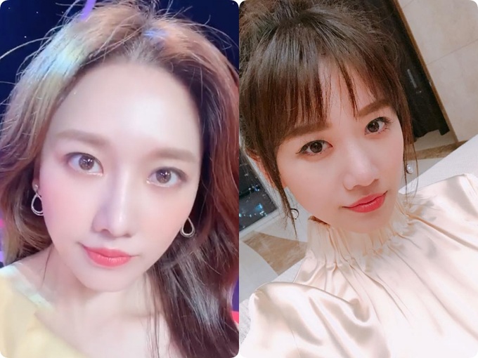Hết Hari Won, giờ lại đến Thiều Bảo Trâm lộ trán "cò bay thẳng cánh", bảo sao nhiều người cứ khư khư tóc mái không rời nửa bước - Ảnh 1. Hết Hari Won, giờ lại đến Thiều Bảo Trâm lộ trán "cò bay thẳng cánh", bảo sao nhiều người cứ khư khư tóc mái không rời nửa bước - Ảnh 1.