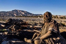 Bác sĩ kinh ngạc khi khám sức khỏe cho ông cụ "67 năm không tắm"