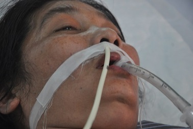 Thiếu 50 triệu, người phụ nữ đứng trước nguy cơ tử vong vì bệnh nhược cơ