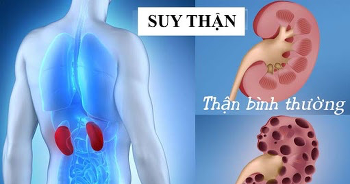 Thận suy yếu âm thầm, 7 việc cần làm ngay để bảo vệ