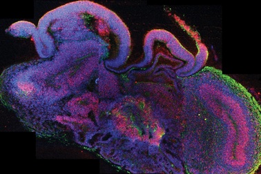 Tạo ra não người, khoa học đang ‘đi quá giới hạn’?