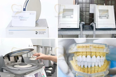 Nguy cơ tiềm ẩn từ bọc răng sứ kém chất lượng