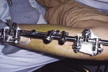 Khát vọng mang tên "chiều cao" 