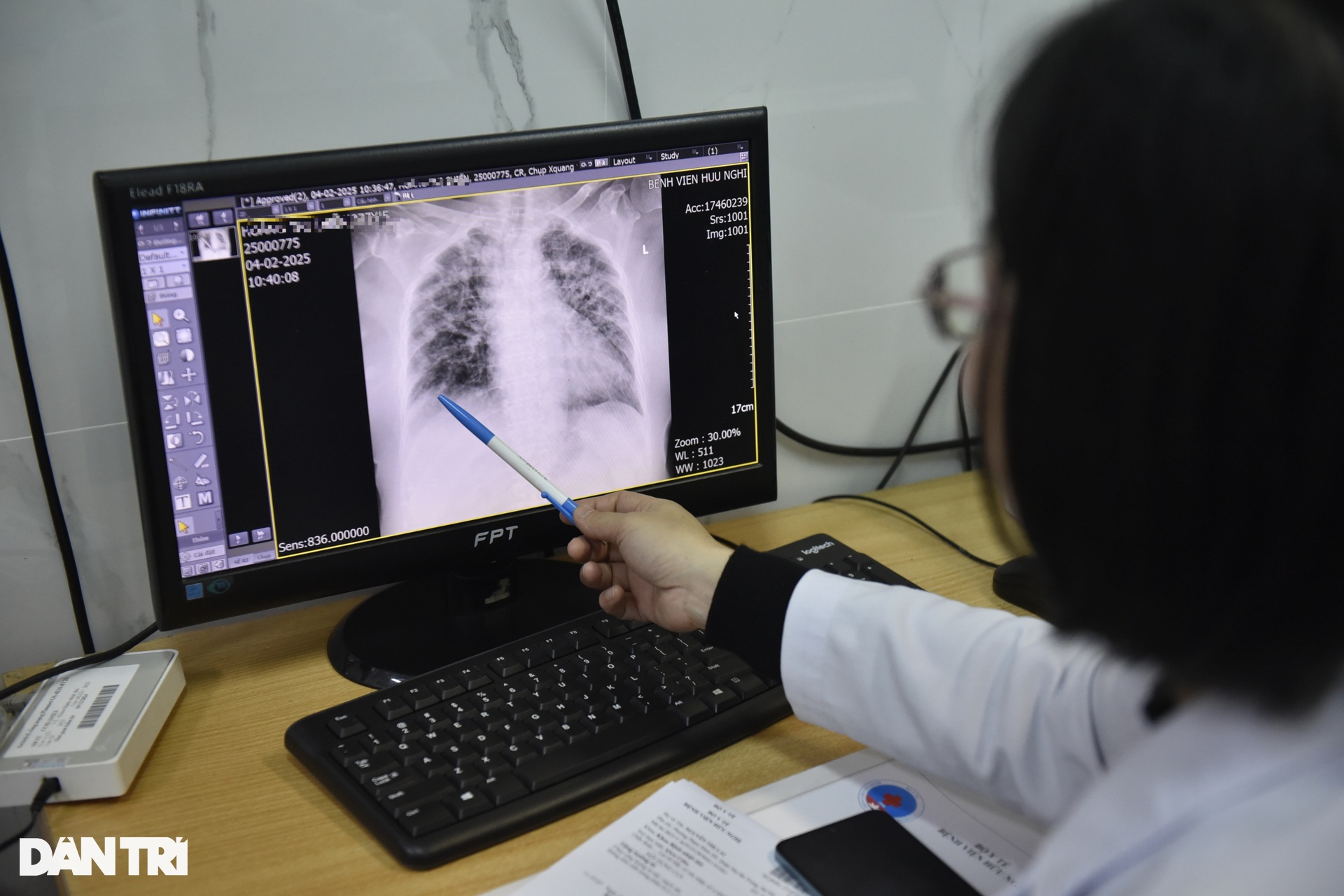 Bệnh nhân phổi trắng, mất Tết vì cúm A - 2 Bệnh nhân phổi trắng, mất Tết vì cúm A - 2
