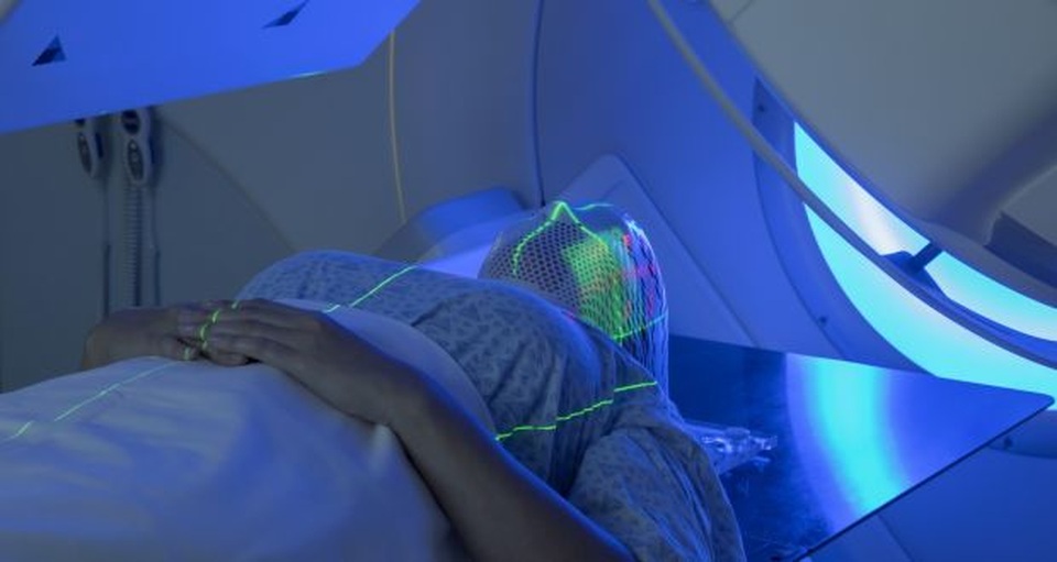 Xạ trị gây nên những tác dụng phụ gì? - 1