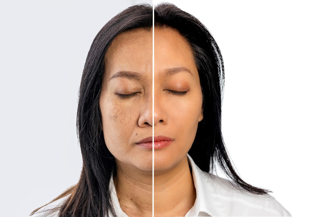 Chuyên gia da liễu chia sẻ bí quyết giúp chị em luôn sở hữu làn da sáng mịn, săn chắc sau tuổi 30 - 2 Chuyên gia da liễu chia sẻ bí quyết giúp chị em luôn sở hữu làn da sáng mịn, săn chắc sau tuổi 30 - 2