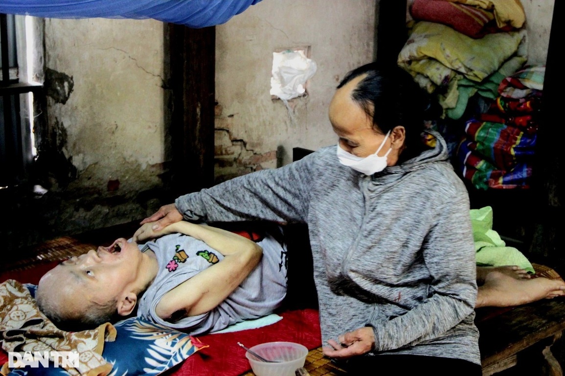 Thương người vợ còm cõi nuôi chồng và con bại não, bữa cơm nào cũng khóc - 3 Thương người vợ còm cõi nuôi chồng và con bại não, bữa cơm nào cũng khóc - 3