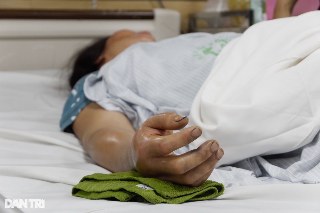 Sau nhát cắn của con không chân, nhiều người hoại tử vì trúng độc - 3 Sau nhát cắn của con không chân, nhiều người hoại tử vì trúng độc - 3