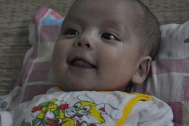 Thương bé 3 tháng tuổi mắc bệnh tim bẩm sinh nặng