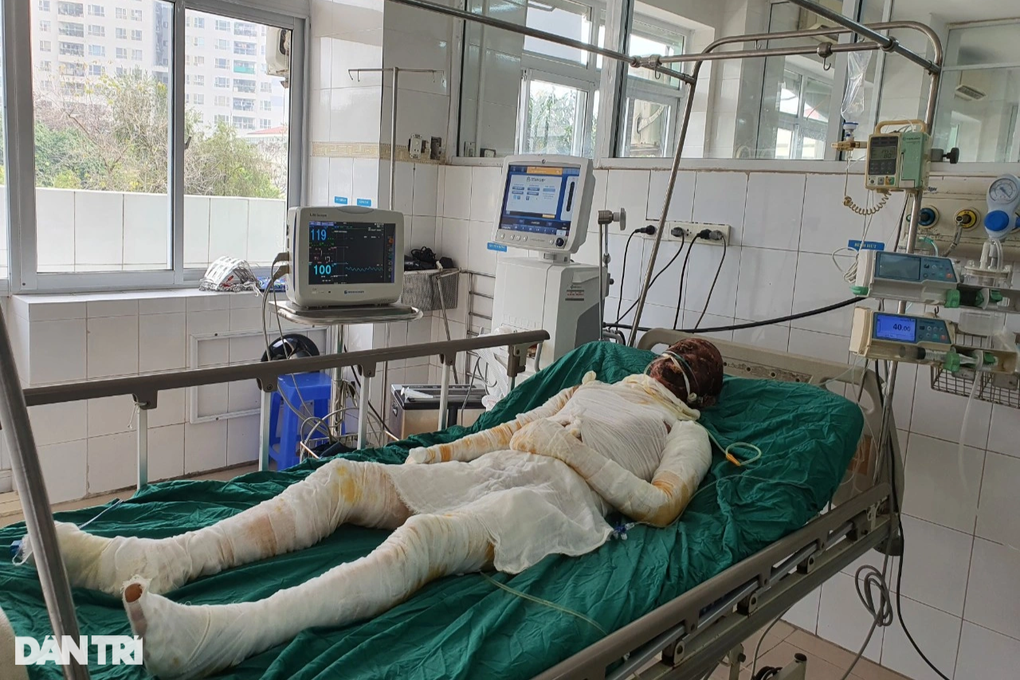 Bạn đọc ủng hộ người đàn ông bị bỏng khí gas hơn 640 triệu đồng - 2 Bạn đọc ủng hộ người đàn ông bị bỏng khí gas hơn 640 triệu đồng - 2