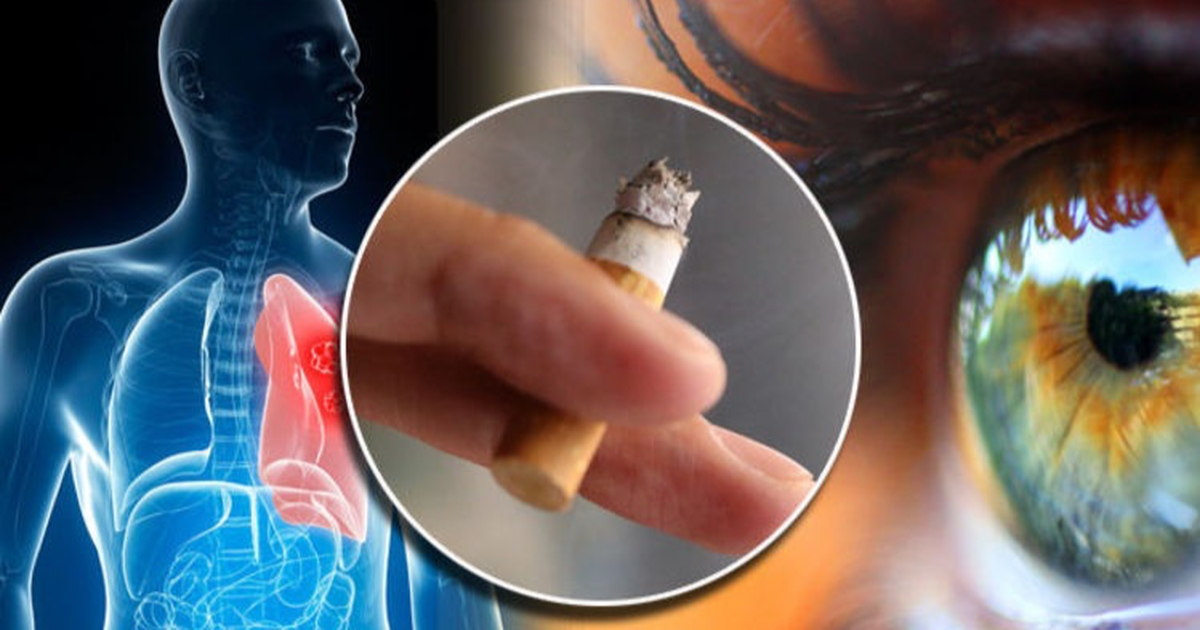 Ước tính cứ 2 người hút thuốc lá sẽ có 1 người chết sớm