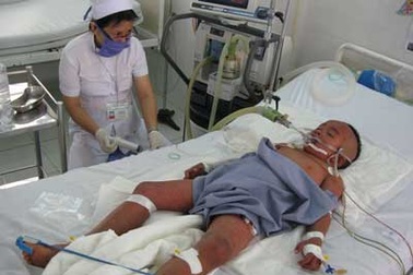 Cứu sống cháu bé bị sốt xuất huyết nặng