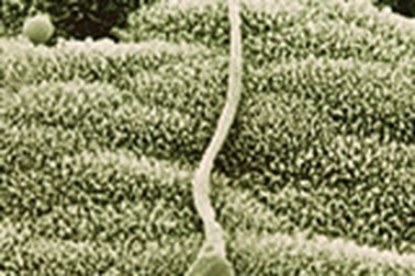 Tinh trùng: Lượng ít có đáng ngại?