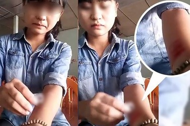 Khi người trẻ thích rạch tay, xăm kín mặt hủy hoại bản thân