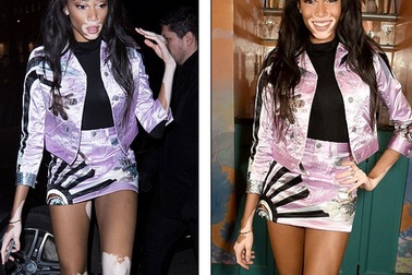 Người mẫu bạch biến đắt show tại tuần lễ thời trang