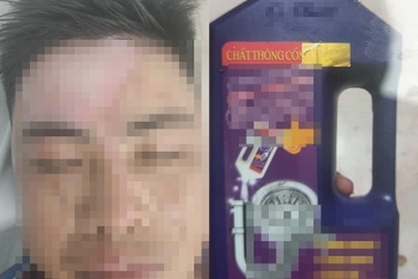 Bị chất thông cống phụt vào người, thanh niên bỏng hết vùng mặt