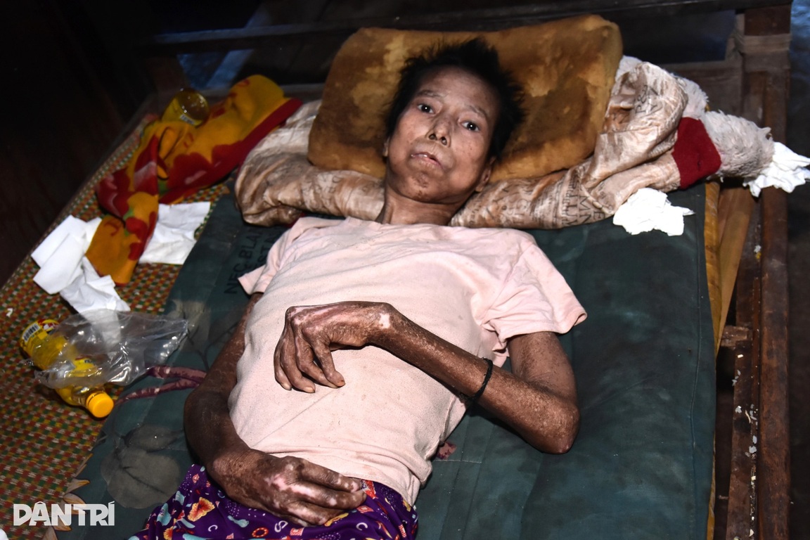 Lay lắt phận đời mẹ khuyết tật đặc biệt nặng, con thơ câm điếc