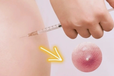 Cô gái 20 tuổi đột quỵ sau thời gian dùng nội tiết tố để chuyển giới