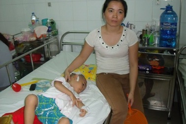 Cháu bé bị cha chém đã được ghép xương sọ