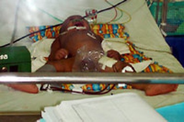 Gia đình bé Thiên Bảo sẽ kiện Trung tâm y tế quận 5